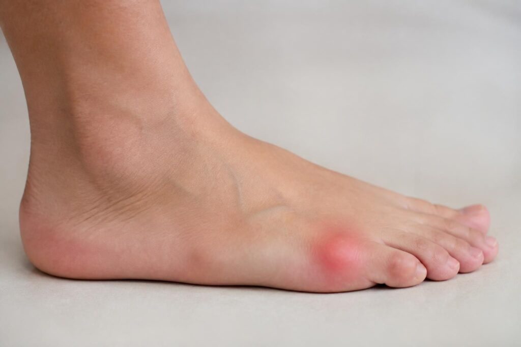 découvrez comment identifier rapidement les premiers signes de la bursite du pied pour agir efficacement et soulager la douleur avant qu'elle ne s'aggrave.